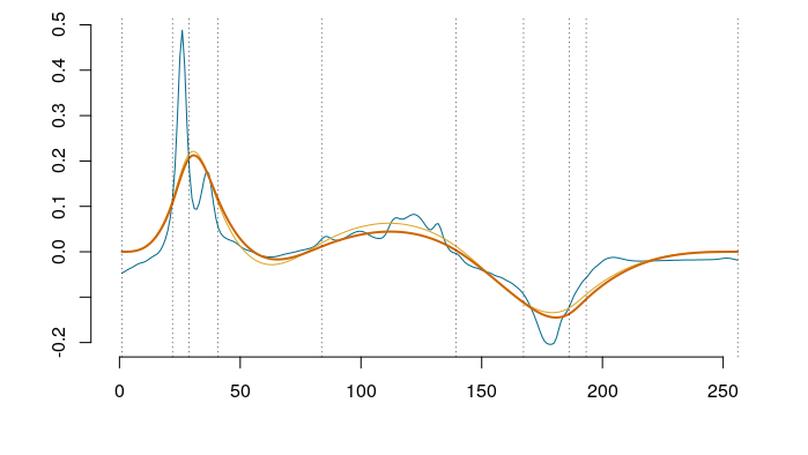 Machine Learning Assisted Orthonormal Basis Selection for Functional Data Analysis